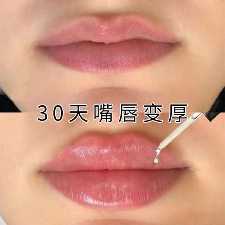 【小红书达人推荐】丰唇精油神器薄嘴唇变厚 ...