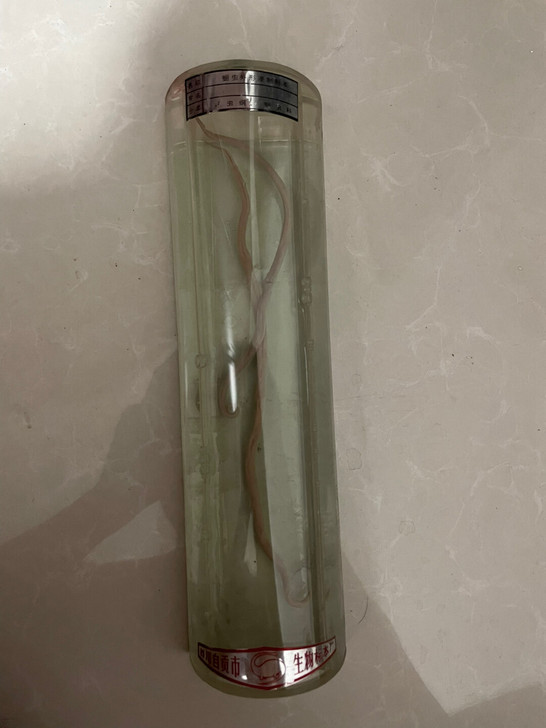 全网唯一 蛔虫标本
